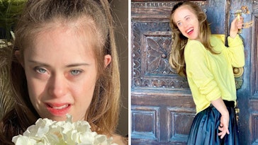 down syndrome model